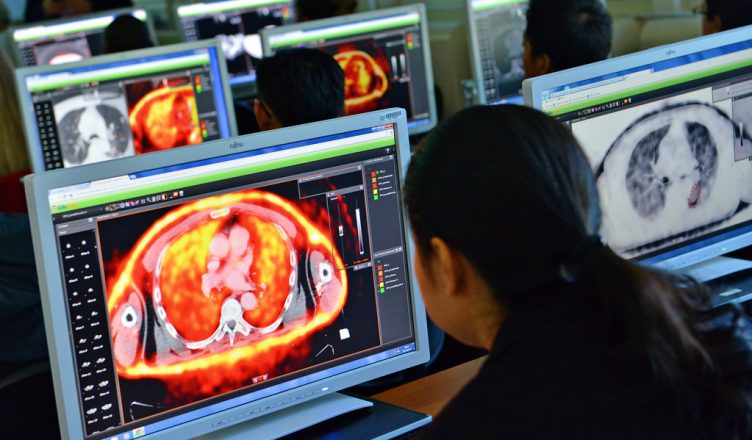 radioterapia - imagem