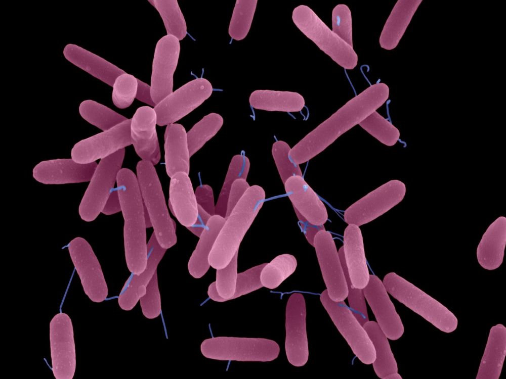 Pseudomonas aeruginosa