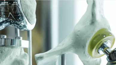 Liga de titânio no osso