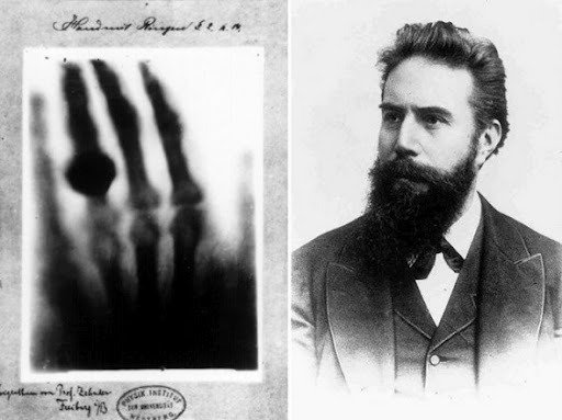  Wilhelm Conrad Röntgen e a 1ª radiografia da História