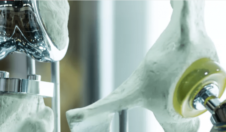 Liga de titânio no osso