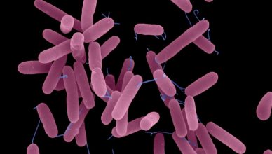 Pseudomonas aeruginosa